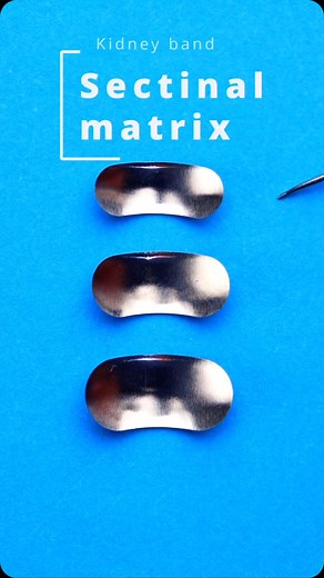 Post by • @khaled_maher953 Sectional Matrix 🧐 Do You Like It ?? ___Follow me NOW To See Next case ❤️ What about your opinion ? 🤔 #compositerestoration #dentistry #doktergigi #dentistrysociety #dentist #iraqi #iraqdentist #directcompositerestoration #dentistsofinstagram #cosmeticdentistry #digitaldentistry #aestheticdentistry #rubberdam #biomimeticdentistry #dentistrylifestyle #styleitalianot #keepitneat #directcomposite #compositefilling #dentalphotography | identistry