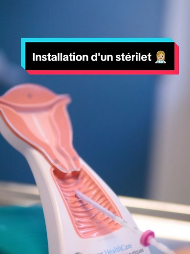 Installation d'un stérilet par une infirmière praticienne