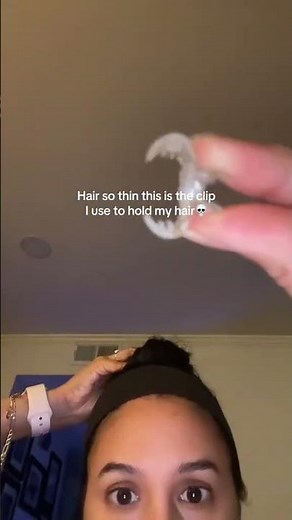 When Your Hair Is So Thin Even a Paperclip Could Hold It 💀🔗😂 | by @maddnessss_ #hairtok #hair