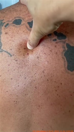 Effective Ear Cleaning Techniques for Earwax Removal