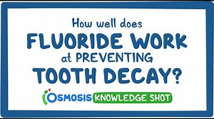 Knowledge Shot: How well do fluoride treatments work at preventing tooth decay: Video, Causes, & Meaning | Osmosis
