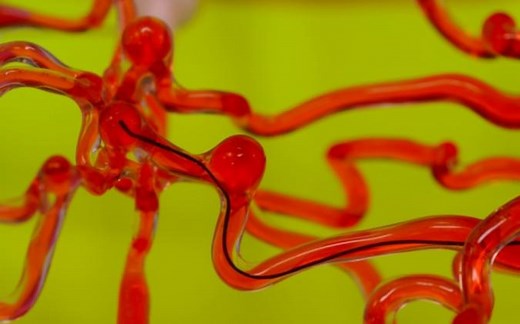 MIT’s thread-like robot can slip through blood vessels in your brain