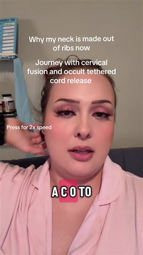 For people with HEDS if you are slowly losing the ability to walk, please watch this! And look into CCI as well as tethered cord syndrome because no doctor in the United States ever brought them up to me. #cci #aai #tetheredcordsyndrome #eds