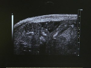 Fetal Mouse Cardiovascular Imaging Using a High-frequency Ultrasound 30/45MHZ System