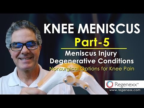 Knee Meniscus Part 5 - Nonsurgical Options for Knee Pain, Meniscus Injury, Degenerative Conditions.