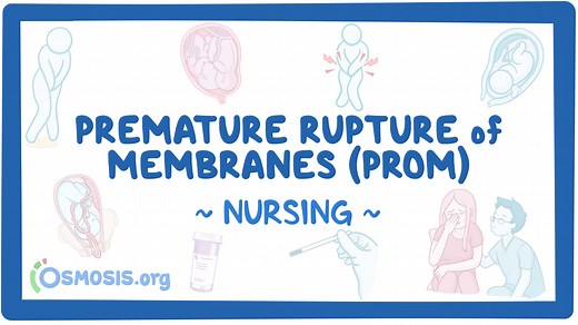 Premature rupture of membranes (PROM): Nursing: Video & Causes | Osmosis