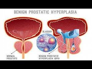 Understanding Prostate Function and Its Role in Male Reproductive Health