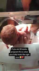 If you are 28 weeks pregnant this is what your baby looks like 🥺❤ #28weeker #28weeks #28weekspregnant | Twin pregnancy