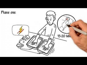 3 Phase Treatment Schedule - How Often Should You Be Using Your Iontophoresis Device? RA Fischer Co.