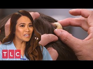 Dr. Pimple Popper Gets Sprayed With Cyst Juice In The Season 2 Finale