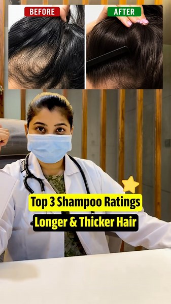Top 3 Shampoos for Hair Fall