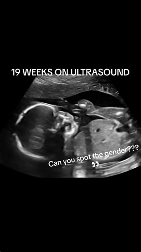 19 Weeks Pregnant Ultrasound Gender Reveal