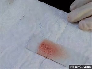 Making a blood smear on Make a GIF