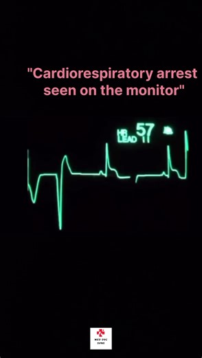 #DoctorLife #Healthcare #emergency #ECG #health