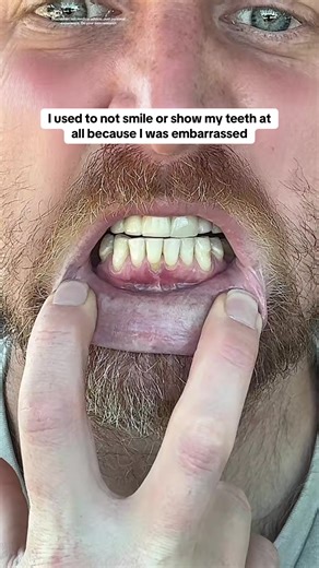 Transforming Dental Health with the Right Toothpaste