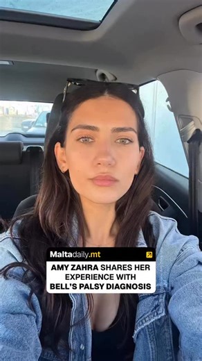 @amyzahra98x , a Maltese model, took to Instagram last night to share her journey after being diagnosed with Bell’s palsy. “As we step into the new year, I’ve been reflecting on one of the hardest moments on 2025,” stated Amy. She proceeded to explain how while doing the Puttinu Walk, she was overrun with numbness and tingling on the right side of her face. “I truly believed I was having a stroke,” she stated. The next day, she was diagnosed with Bell’s palsy; sudden inflammation of the facial n