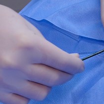 Video: Novel Percutaneous Approach for Deployment of 3D Printed Coronary Stenosis Implants in Swine Models of Ischemic Heart Disease