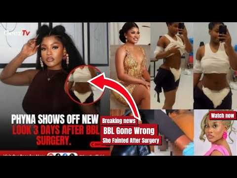 BBL Gone Wrong | She Fainted After Surgery