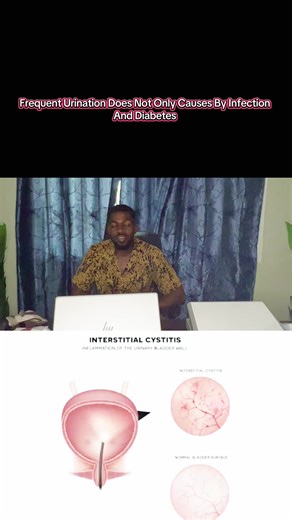 Prostatitis: Painful Urination Causes