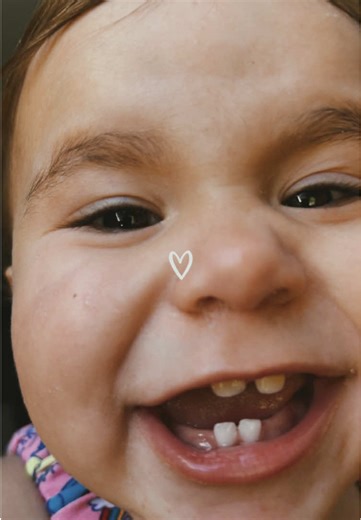 My Boogie Bug baby! Them Teethies!!!!!