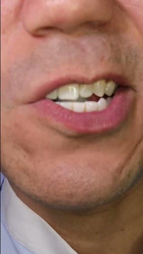 ASMR | Prepare for puckering of lips before the taste of fizzy sweetness