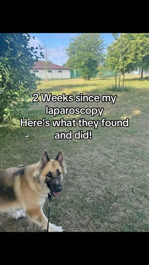 Laparoscopy: The Future of Diagnosis & Treatment