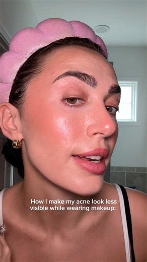 How to make your acne look less visible! #acne #acneproneskin #acnetips #acnemakeup #makeuphacks