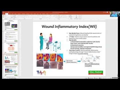 The Roadmap to Ulcer-Free Living: AI, Thermal Imaging, and Diabetic Self-Care