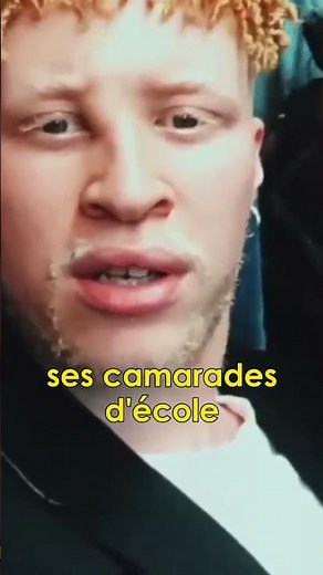 Voici Le Mannequin Qui Fait le Buzz Actuellement !