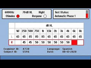 Testing with the RA360 audiometer