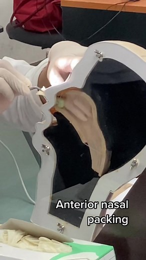 Understanding Anterior Nasal Packing Techniques