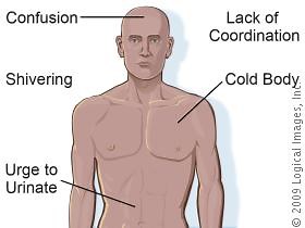 Hyperthermia and Hypothermia