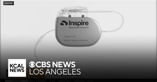 Groundbreaking sleep apnea treatment helping children with down syndrome get help they need