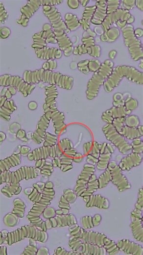 Bacteria in Blood Under the Microscope #microphotography #microworld #microscope #underthemicroscope #science #biology #blood #bacteria | Microworld Explorer