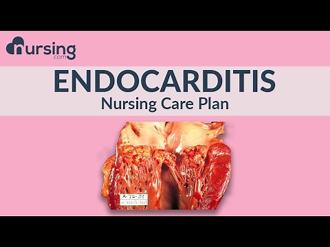 What is Endocarditis, and how to write a care plan for it as a nurse... Nursing care plan