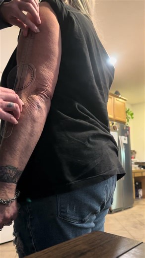 Elbow extension goniometer