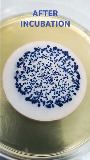 Membrane Filtration Technique | E. coli #shorts #viral #MembraneFiltration #Microbiology