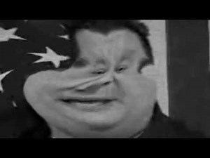 МОЁ ОТНОШЕНИЕ К МИРУ ПОСЛЕ ТОГО КАК МЕНЯ ПОЛНОСТЬЮ ВЫЛЕЧИЛИ ОТ ГИПОКСИИ