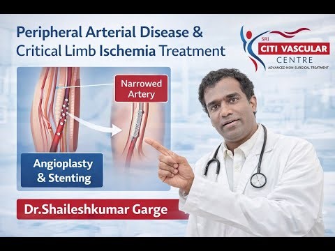 Peripheral arterial disease & critical limb ischemia treatment by angioplasty & stenting