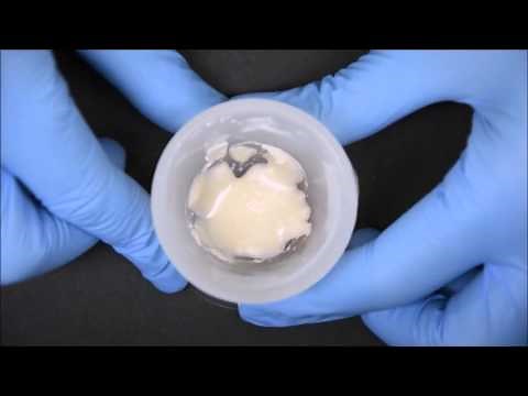 PROVISIONAL RESTORATION - INDIRECT DIRECT TECHNIQUE - 3 UNIT FPD