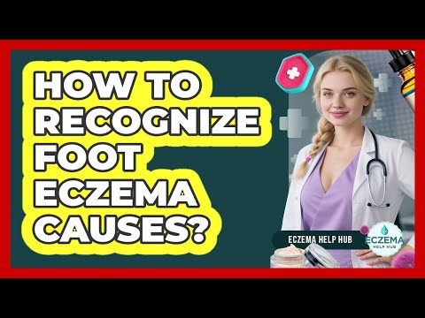 How To Recognize Foot Eczema Causes?