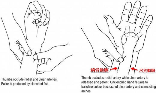 アレンテストとは？ アレンテストの方法