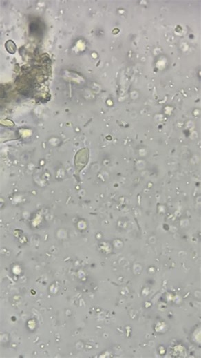 Mustafa Elsobky | Lona 🐈 / Female Scottish Fold / Tritrichomonas foetus ✨🔬 / Wet-Mount Stool Analysis/ 1) Shape: Pear-shaped or spindle-shaped protozoa /2)... | Instagram