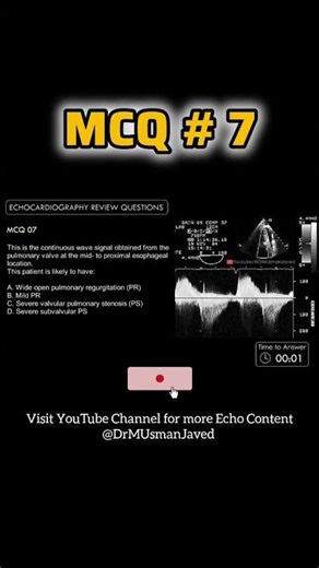 Echo Quiz - #ardms Echocardiography for Beginners