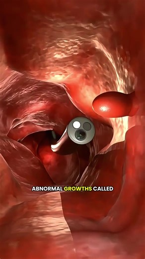 Colonoscopy Procedure Explained: Everything You Need to Know