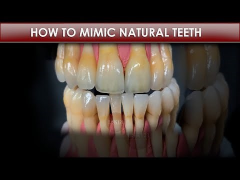 How to Make Fake Teeth Look Real in a Patient's Mouth