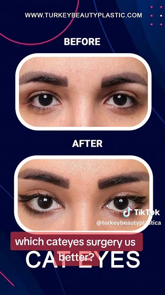 turkeybeautyplastic on TikTok