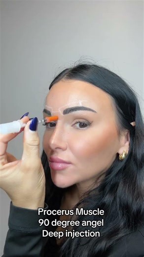 11 lines Botox injection depth! (Glabellar line)