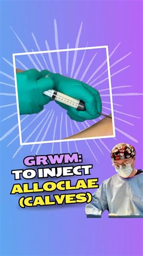 GRWM: Calf Definition & Contour with alloClae | Non-Surgical Leg Sculpting by Dr. Desrosiers