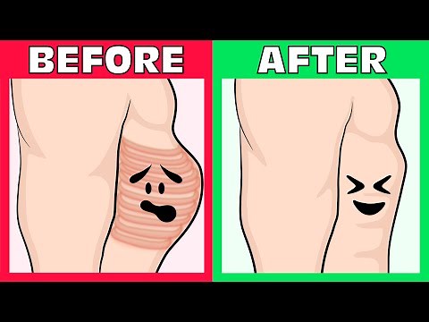 How to Fix Flared Ribs Naturally without any Equipment!